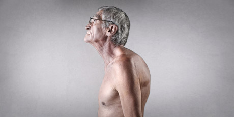 man with poor posture